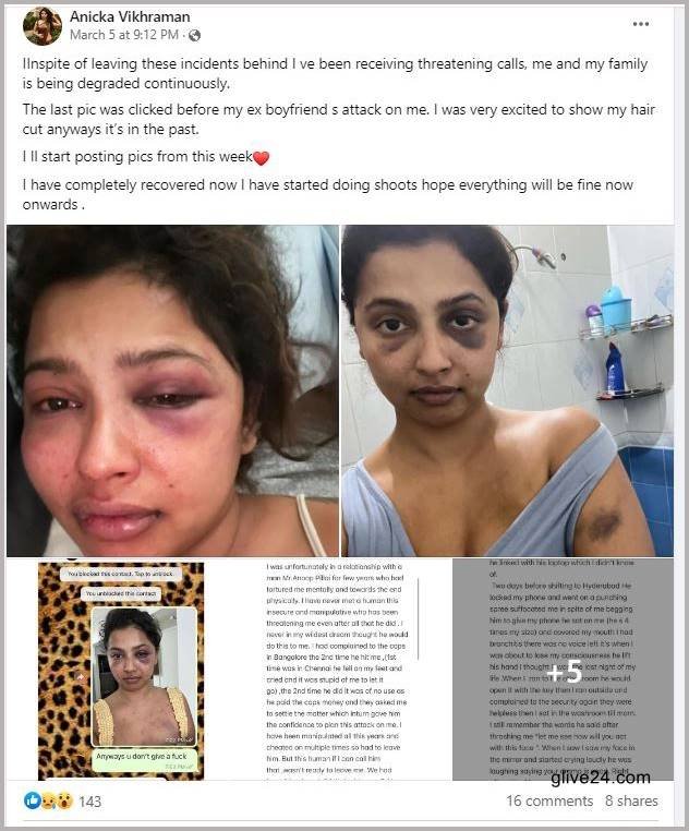  প্রেমিকের কাছে শারীরিক অত্যাচারের শিকার হলেন অভিনেত্রী