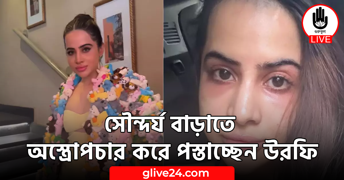 সৌন্দর্য বাড়াতে অস্ত্রোপচার করে পস্তাচ্ছেন উরফি